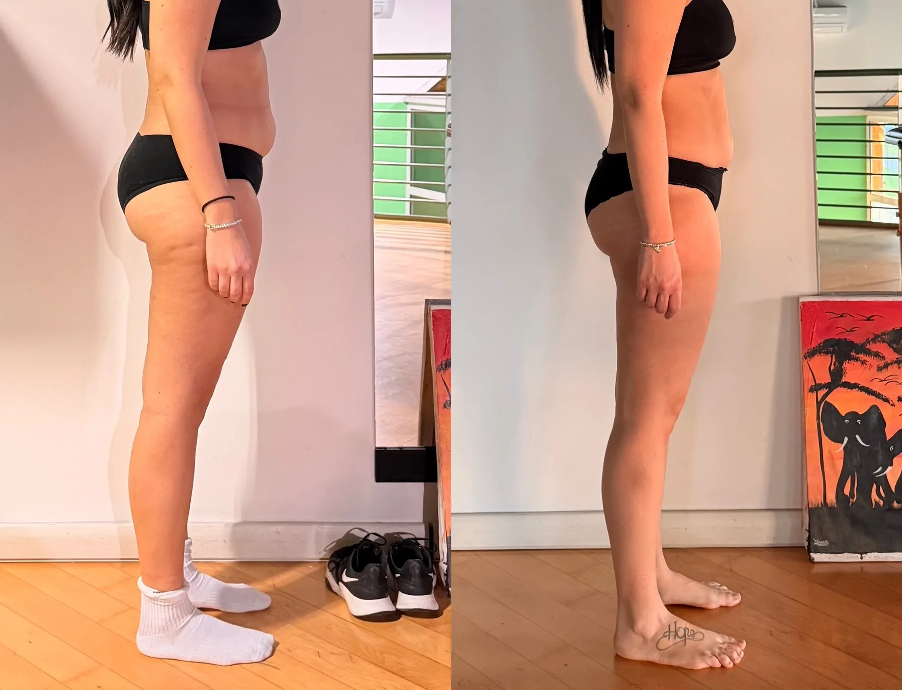 Prima e dopo di una cliente, dopo 1 mese