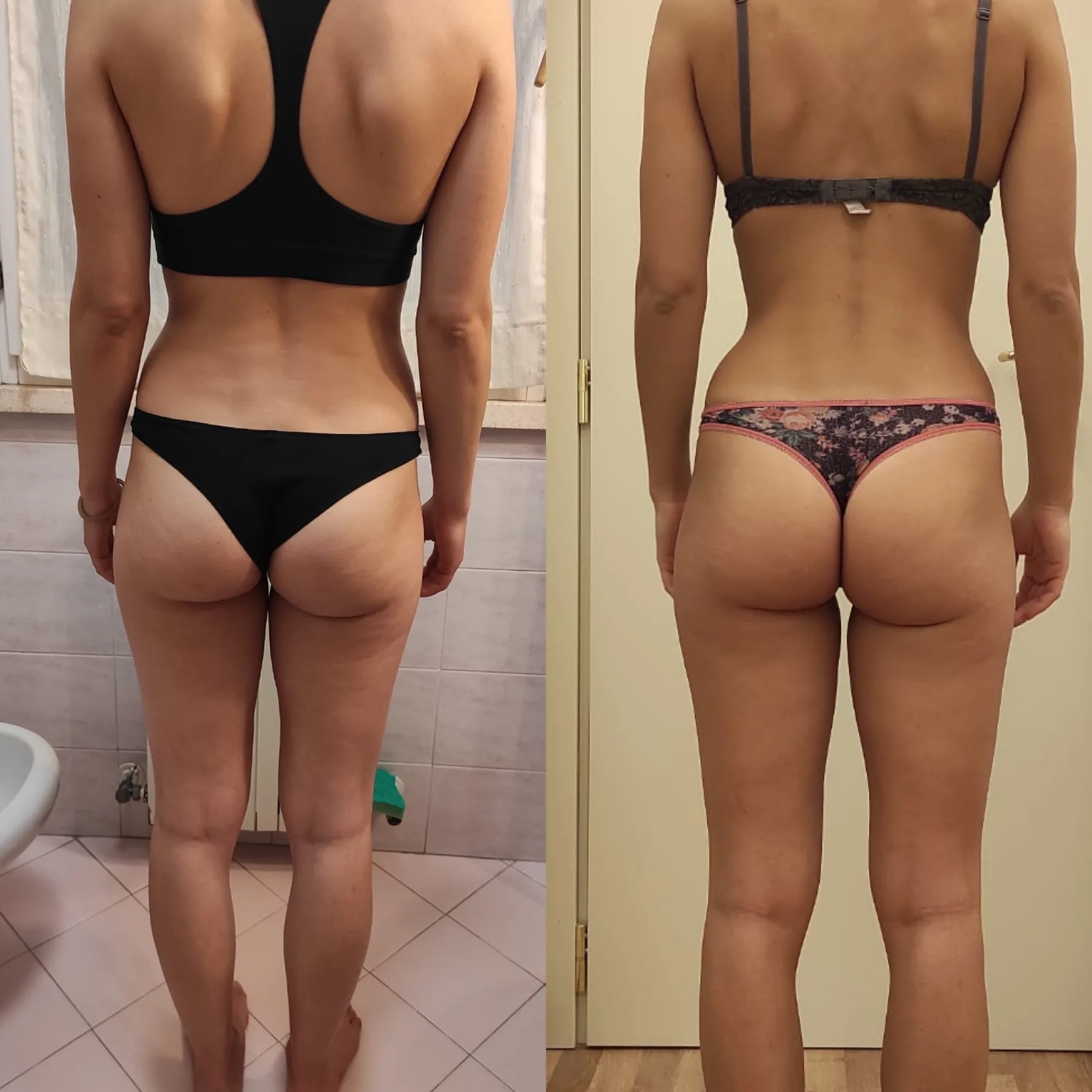 Prima e dopo di una cliente, dopo 3 mesi
